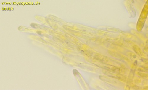 Olla transiens - 