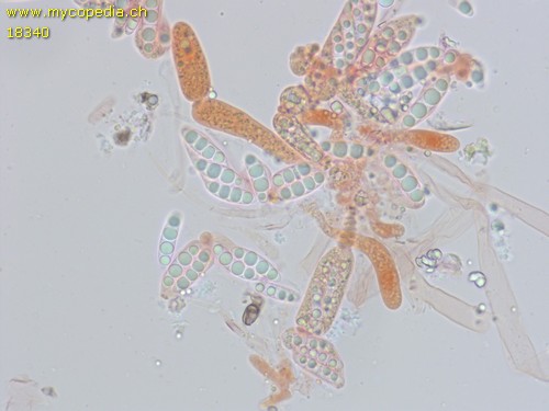 Unbestimmt auf Fagus - Sporen unreif - Kongorot  - 