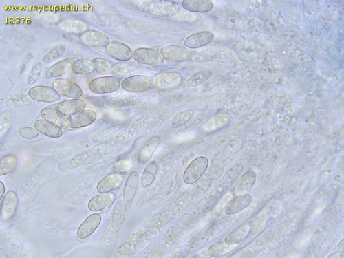 Pseudocosmospora eutypellae - 