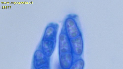 Pseudocosmospora eutypellae - Apikalapparat - 