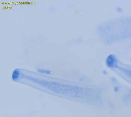 Pseudocosmospora eutypellae - Apikalapparat - 