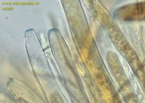 Rutstroemia bulgarioides - 