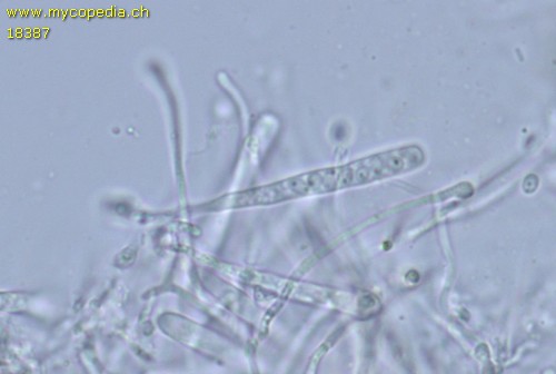 Orbilia eucalypti - 