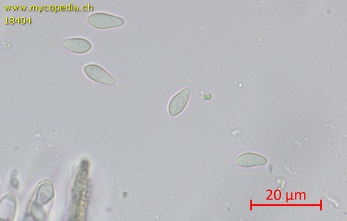 Cyathicula amenti - Spore/n - Wasser  - 