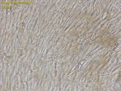 Cyathicula amenti - Excipulum - 