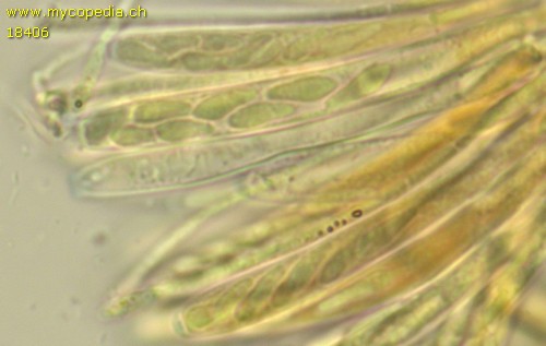 Cyathicula amenti - Asci - Melzers  - 