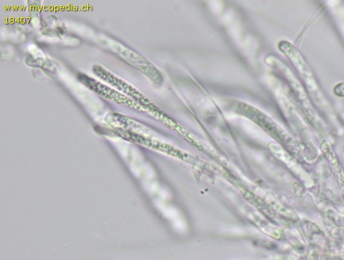 Cyathicula amenti - Paraphysen - 