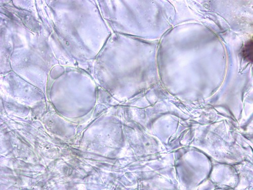 Ascobolus michaudii - Excipulum - 