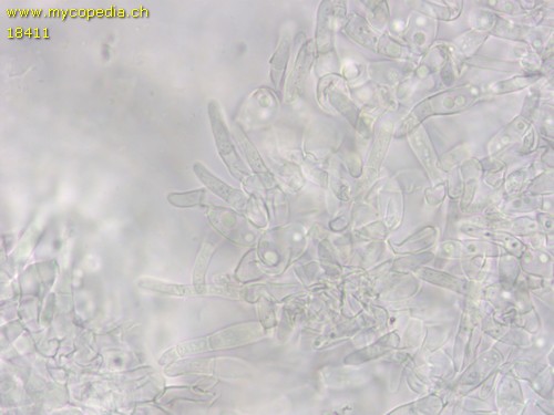 Hypocrea citrina - 