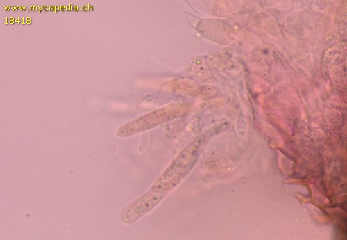 Nitschkia parasitans - Asci - Kongorot  - 