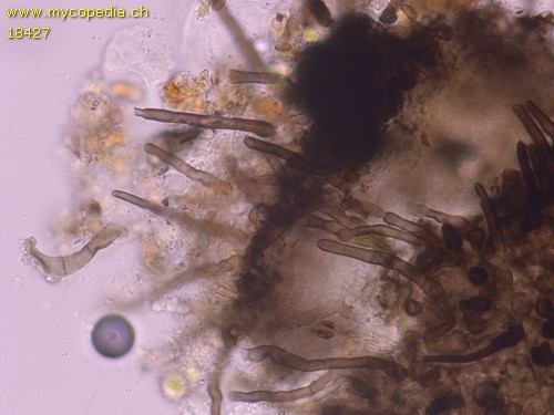 Capronia pilosella - Setae - 