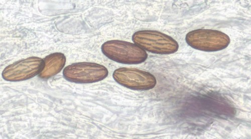 Ascobolus michaudii - 