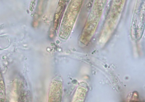 Hymenoscyphus pani - Asci - 