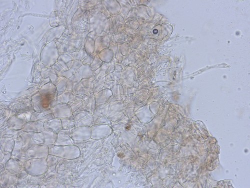 Hymenoscyphus pani - Excipulum - 