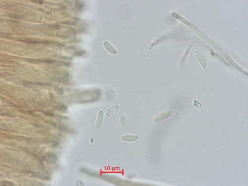 Hymenoscyphus pani - Sporen & Asci - 