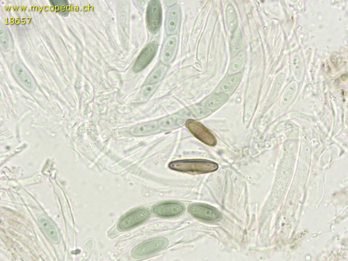 Stenocybe pullatula - 