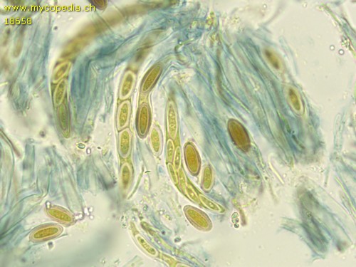 Stenocybe pullatula - 