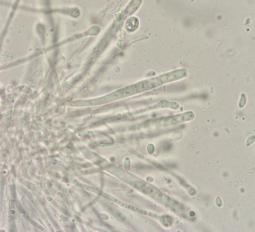 Orbilia eucalypti - Asci & Paraphysen - 