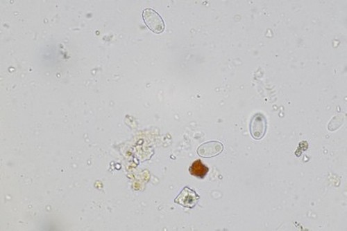 Geoscypha tenacella - 