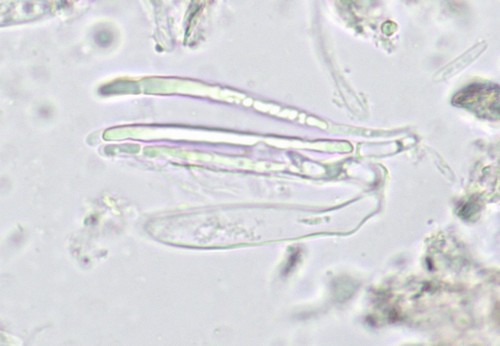 Mollisia sericeomarginata - Paraphysen - 