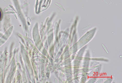 Mollisia sericeomarginata - Sporen & Asci - Wasser  - 