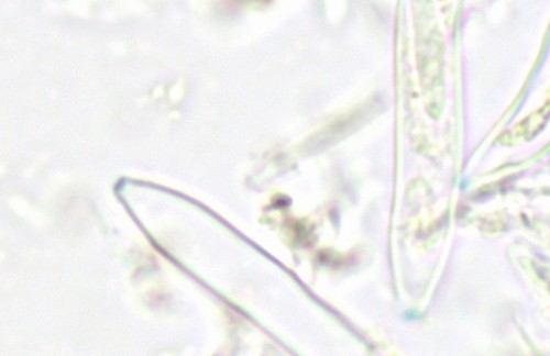 Mollisia sericeomarginata - Asci - Baral  - 