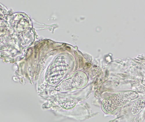 Leptosillia wienkampii - Asci - Wasser  - 