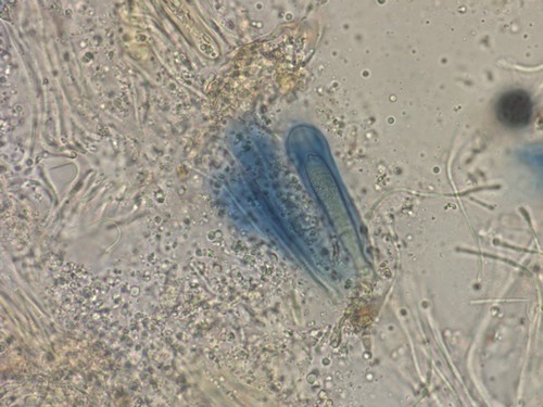 Zythia resinae - Asci - Melzers  - 