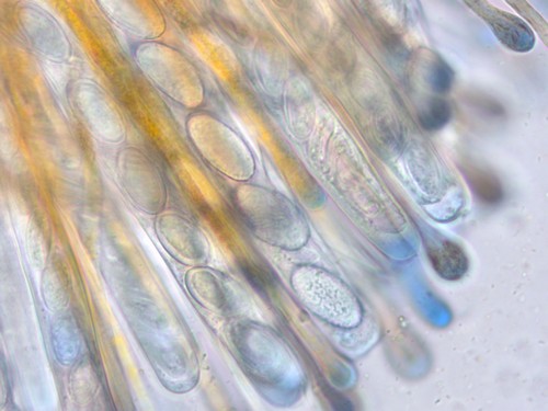 Cheilymenia crucipila - 