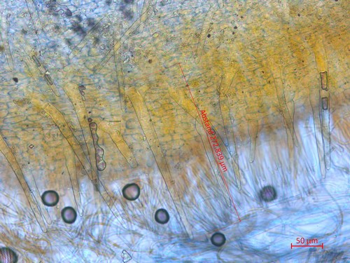 Cheilymenia crucipila - 