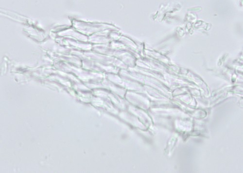 Psilachnum chrysostigmum - Excipulum - Wasser  - 