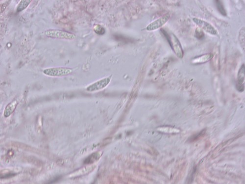 Hypomyces lateritius - 