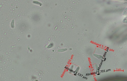 Hamatocanthoscypha conicola - 