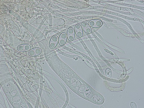 Otidea platyspora - Paraphysen - 