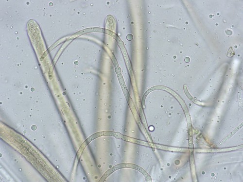 Ophiobolus acuminatus - 