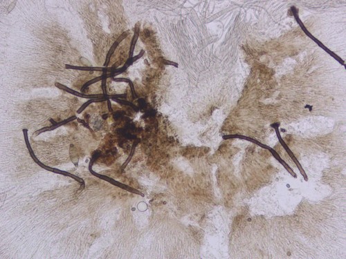 Strossmayeria basitricha - 