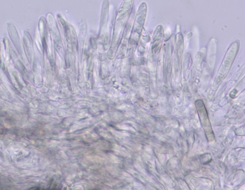 Hamatocanthoscypha conicola - 