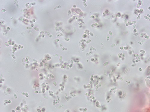Ceriporiopsis gilvescens - 