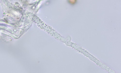 Skeletocutis spec. - Hyphen mit Schnallen - 