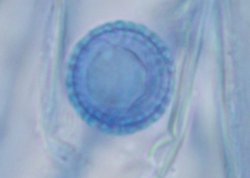 Plicariella scabrosa - 