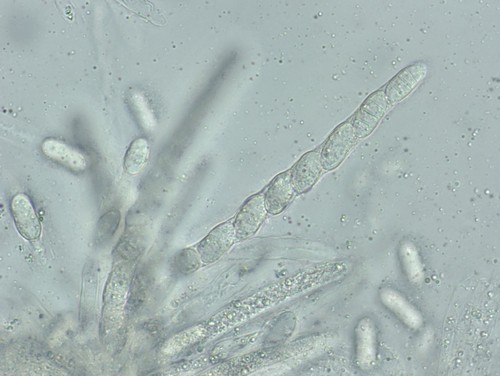 Sporocadus lichenicola - 
