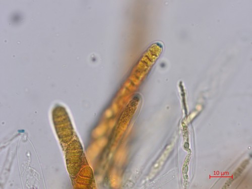 Sporocadus lichenicola - Asci - Melzers  - 