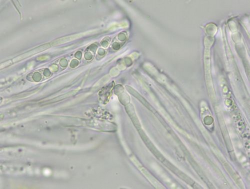 Coenogonium pineti - 