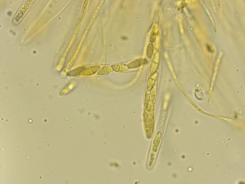 Coenogonium pineti - Asci - Melzers  - 
