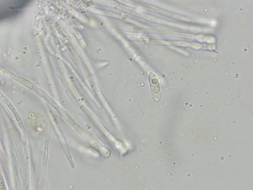 Coenogonium pineti - 