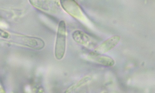 Pezizella alniella - Spore/n - Wasser  - 