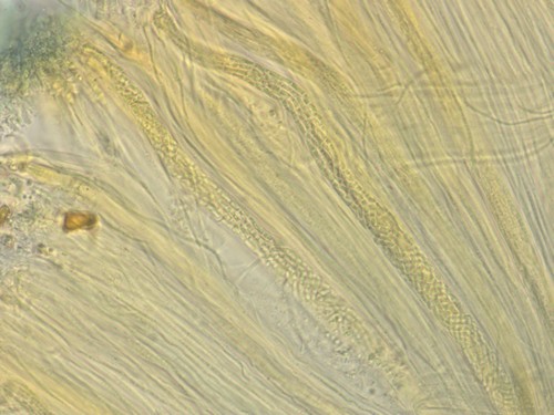 Stictis radiata - Asci - Melzers  - 