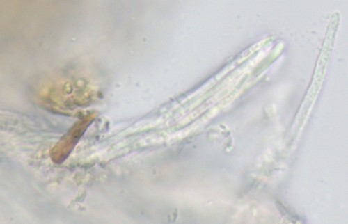 Capitotricha rubi - Asci - 