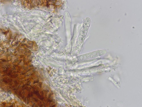 Unguiculariopsis rehmii - Asci - Wasser  - 