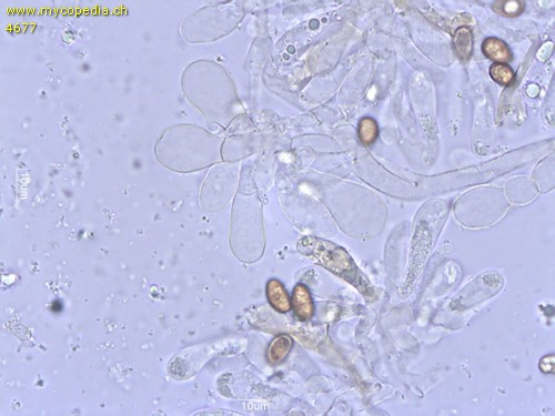 Pholiota carbonaria - Cheilozystiden - 